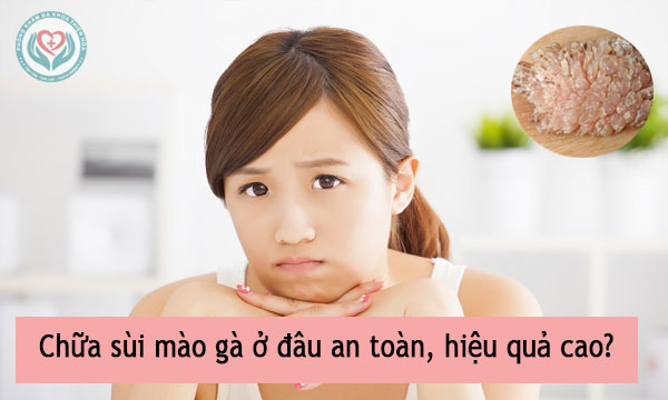 địa chỉ chữa sùi mào gà uy tín