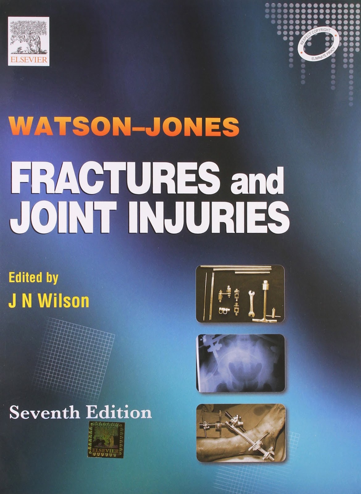 Watson-Jones Fractures &amp; Joint Injuries: WILSON, WILSON, WILSON:  9788131211595: Books - Amazon.ca