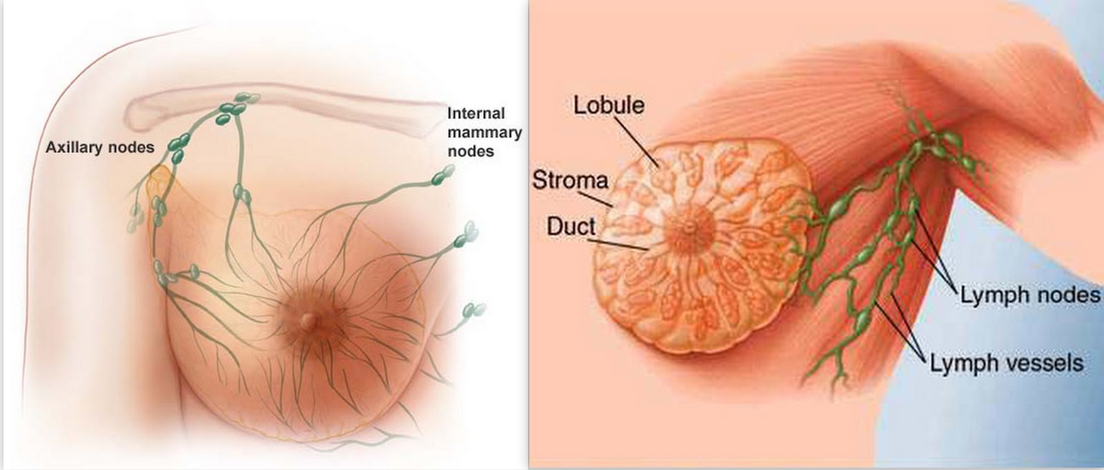 http://cancer-treatment-madurai.com/types-of-cancer-breast-cancer.php