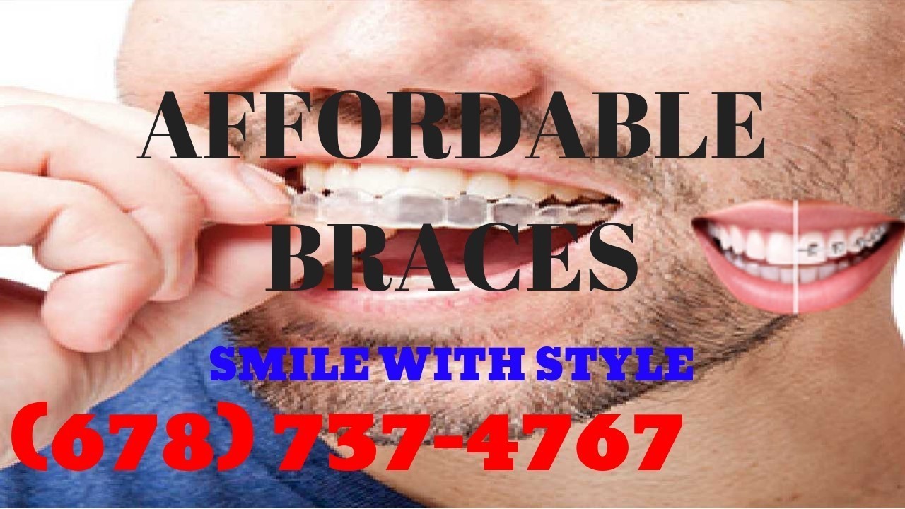 Braces Price Quotes In Atlanta Ga
