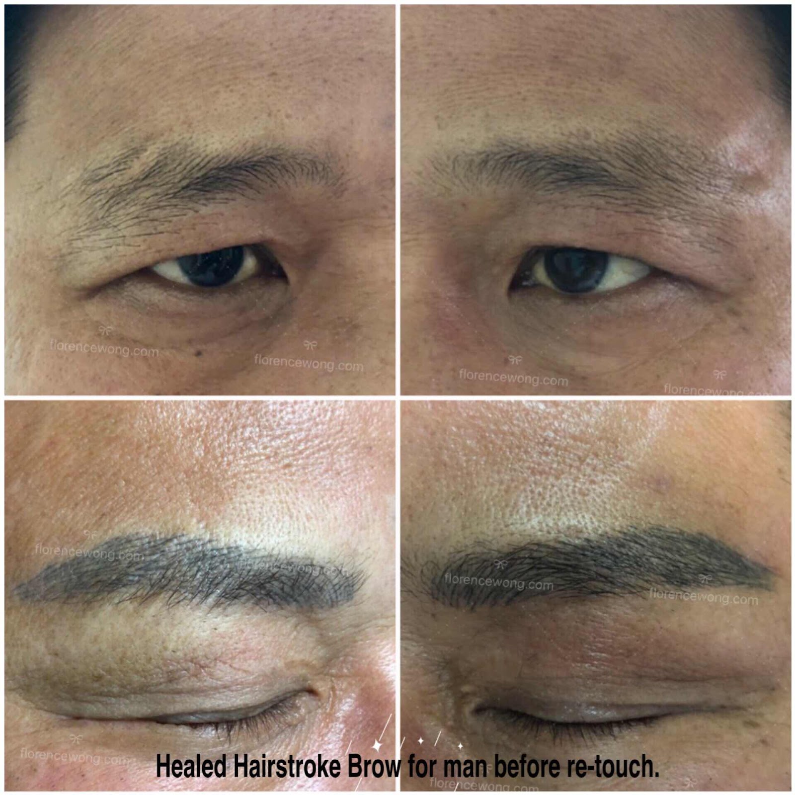 Florence Wong Make Up Artistry Blog Elegant 3d Brow Microblading Concealed Scar Healed Man Hairstroke Eyebrow Final Result