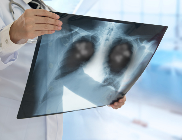 Identifying pneumonia symptoms swiftly is vital to prevent complications.
