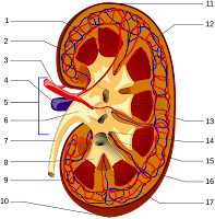 What is Renal artery stenosis(RAS)