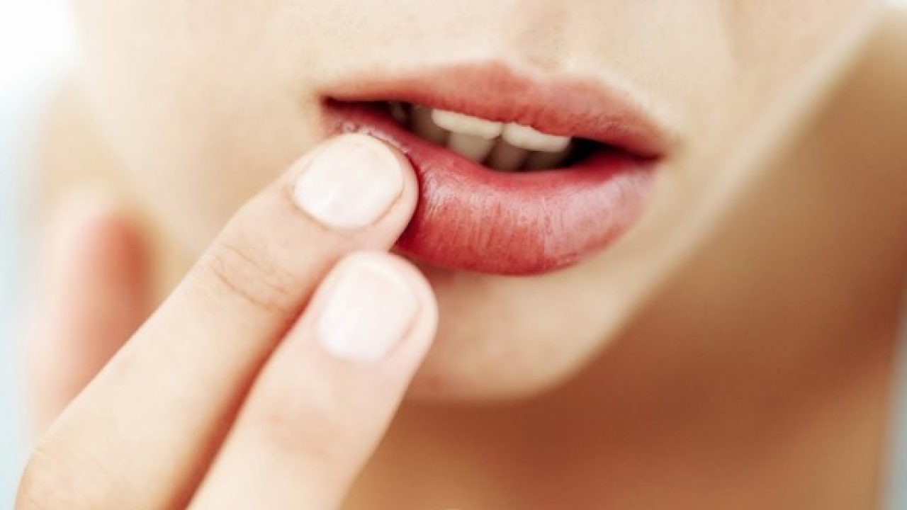 Đôi khi việc bôi Acyclovir sau phun môi có bị thâm môi không còn phụ thuộc vào nhiều vào loại thuốc mà chị em đang sử dụng.