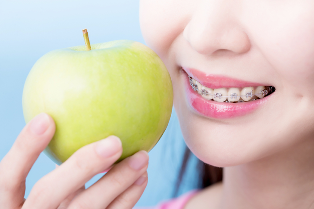 Khi niềng răng nên ăn gì để đảm bảo hiệu quả? 