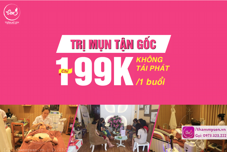 Trị mụn đầu đen hiệu quả