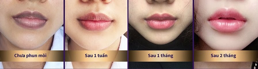 địa chỉ phun môi ở Thanh Hóa