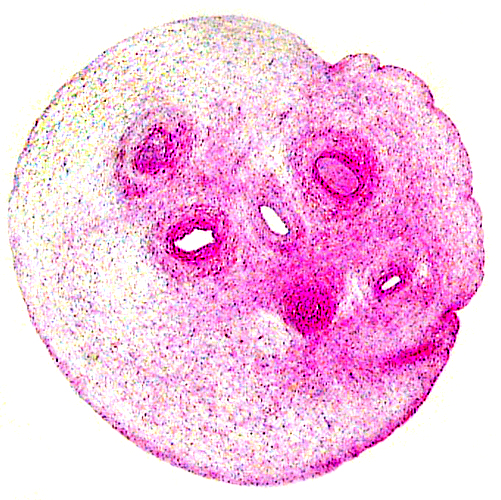 Cross section of the umbilical cord from the immature specimen shown above. In the center is the allantoic duct; there are five blood vessels. Presumably three are chorioallantoic, the two remaining are the vitelline vessels. The surface is smooth.