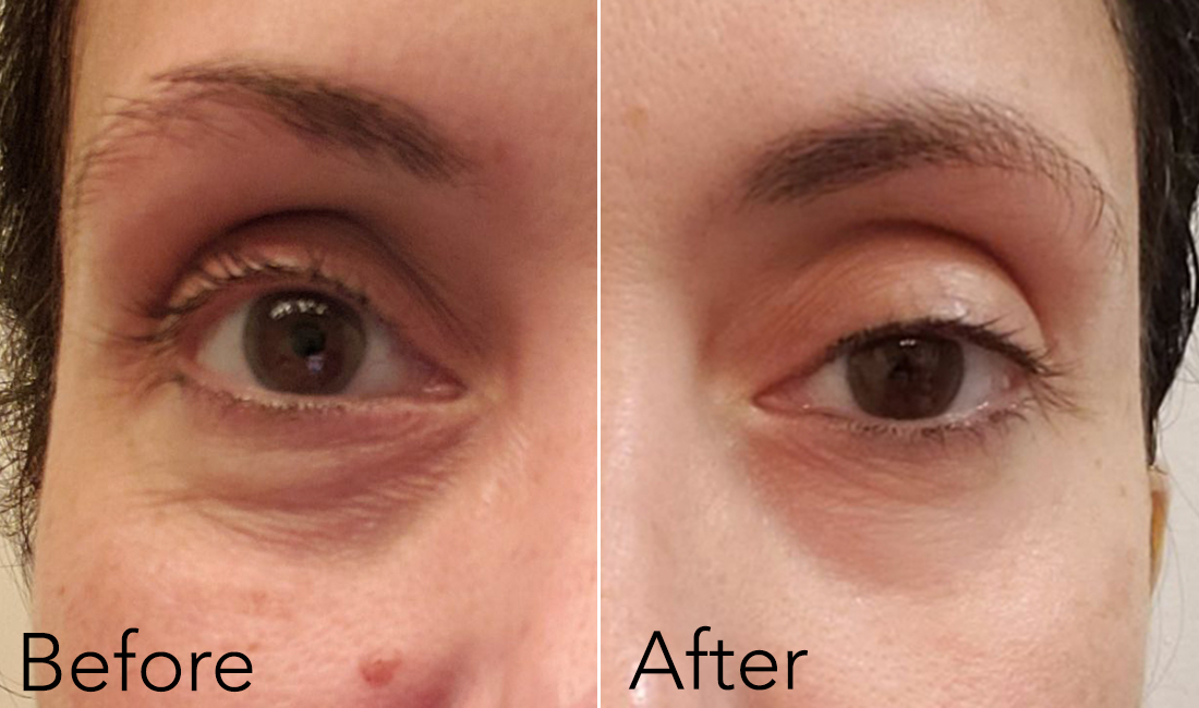 Youthful Eyes Your Guide To Effective Eye Creams