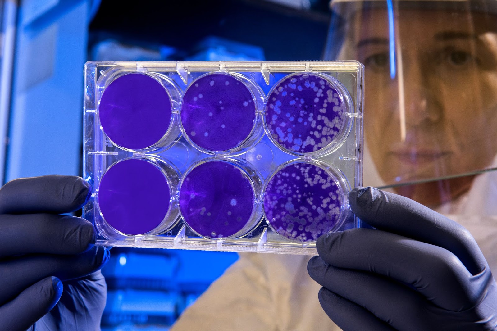  #paratodosverem: uma pessoa usando faceshield, jaleco branco e luvas azuis olhando para a uma placa de cultura de células.  Fonte: Unsplash 