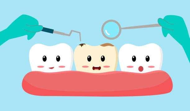 illustration of tooth with dental cavity between two healthy teeth