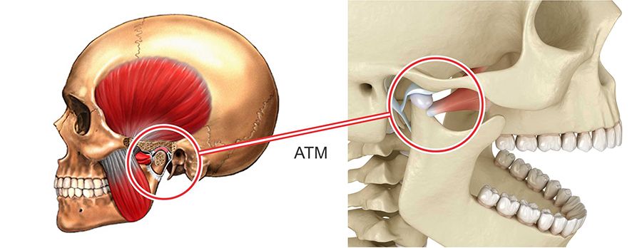 O que é ATM? Como funciona o tratamento para ATM? - Ortodontia