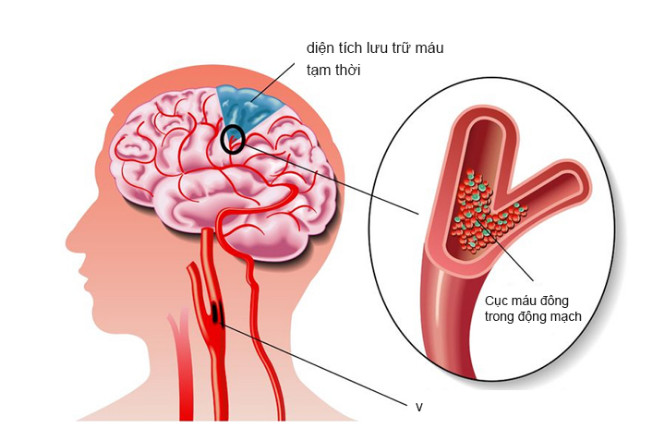 thieu-mau-nao-nen-an-gi-01.jpg