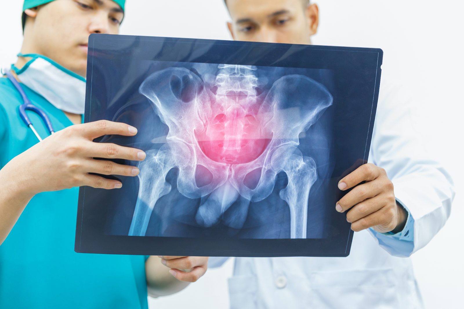 médico segurando um exame de imagem mostrando uma lesão no quadril 