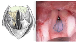 A close-up of the inside of a human body

Description automatically generated