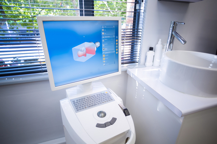 itero scanner itero scanner