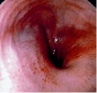 Endoscopy of the distal esophagus of a cat