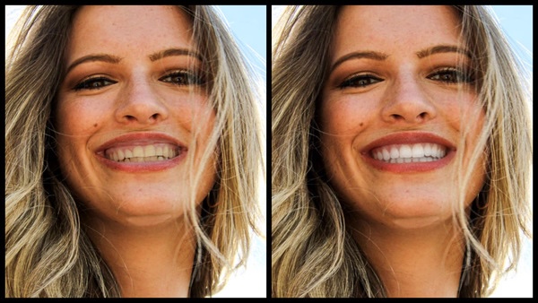 antes e depois da foto de uma mulher loira sendo que uma das fotos o dente está mais branco