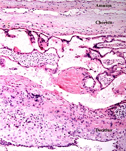 Margin of immature placenta with origin of free membranes. There is a decidua capsularis, quite similar to human gestations and atrophying villi are found