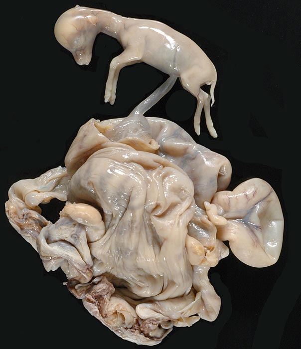 Second fetal kudu attached to placenta in utero.
