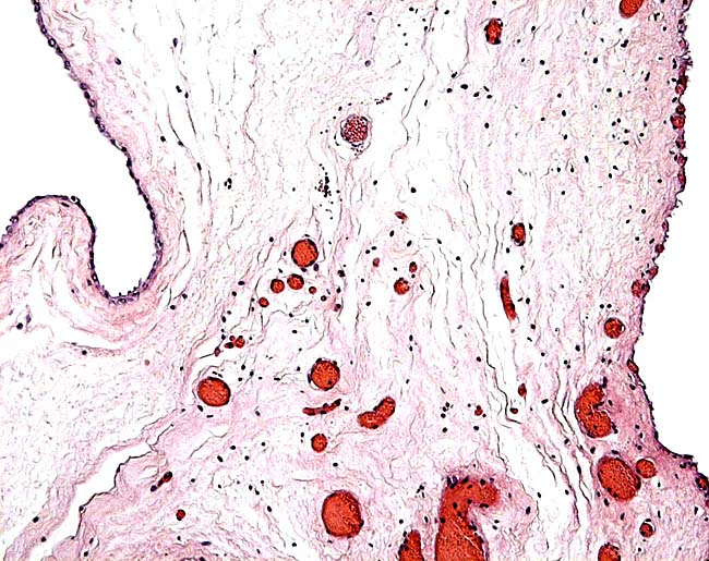 Amnion at left and chorionic membrane at right.