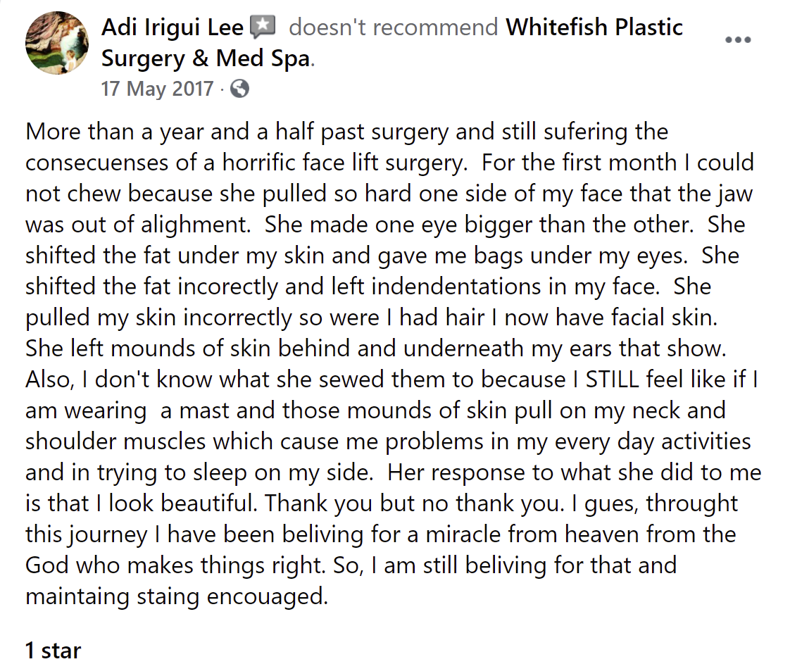 Whitefish Plastic Surgery and Medspa review