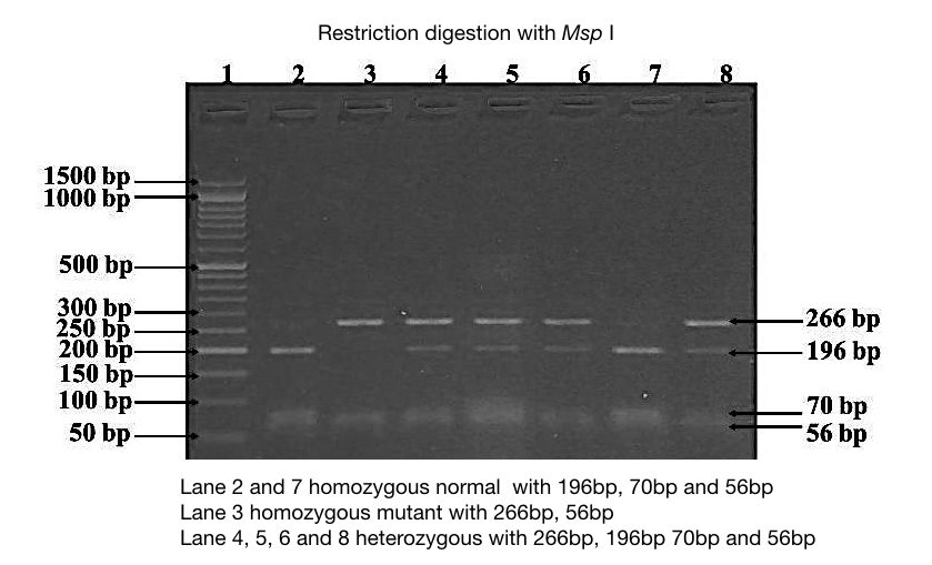 A result of restriction digestion 2