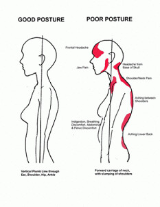 Poor posture affecting women | One of the keys in healing is… | Flickr