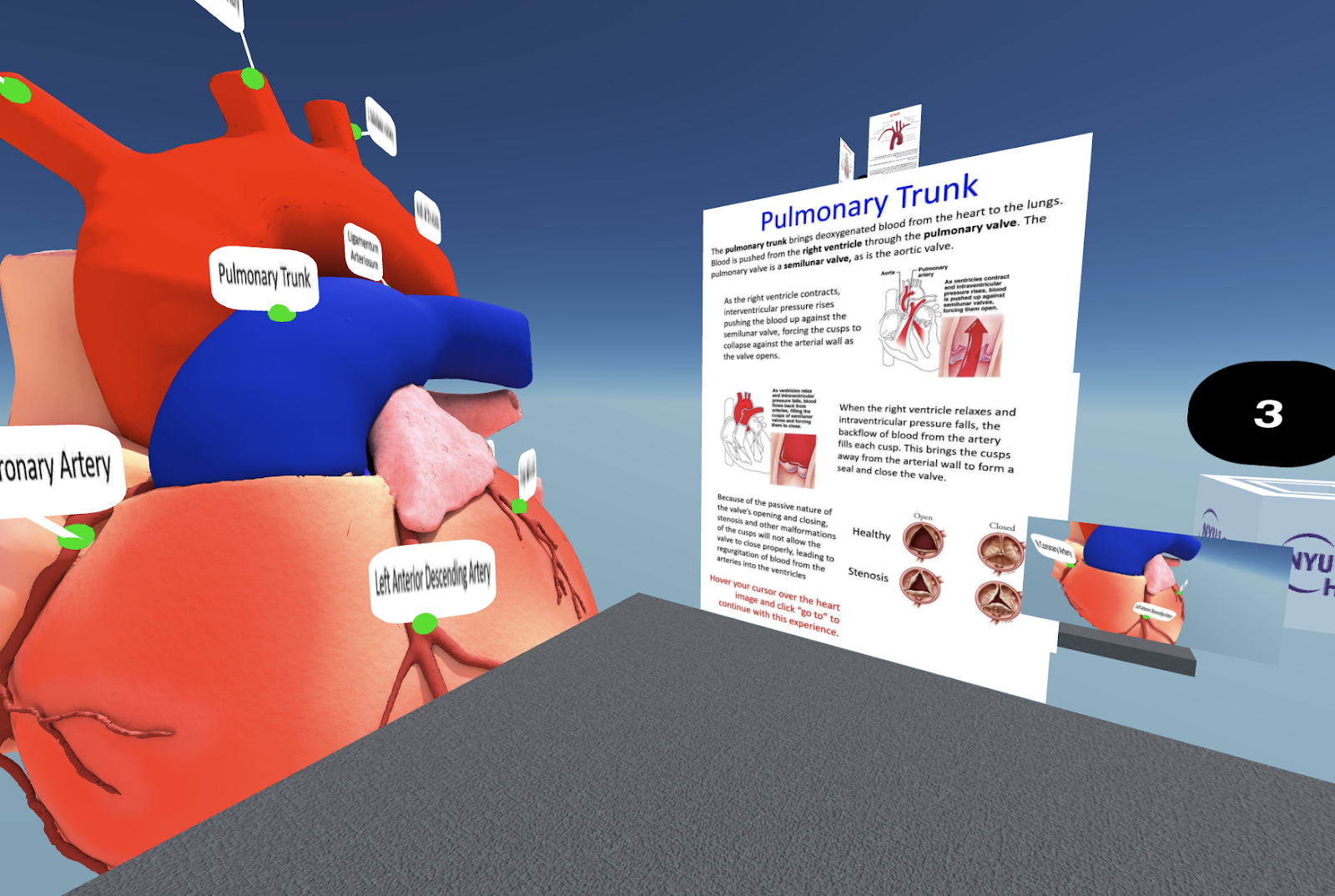 a 3d model of a heart with a poster titled 'Pulmonary Trunk'