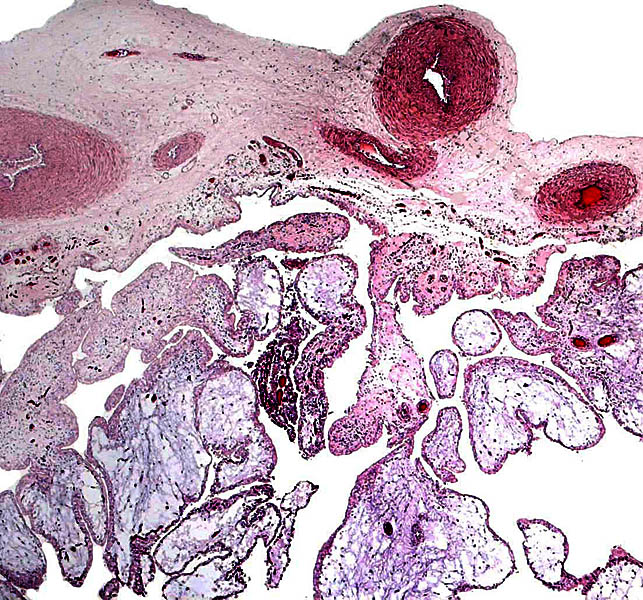 Surface of second placenta