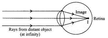 CBSE Previous Year Question Papers Class 10 Science 2017 Outside Delhi Term 2 Set I Q24