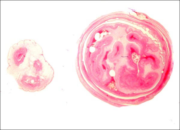 Cross-section of umbilical cord of rhesus macac at left, and of rolled membrane at right