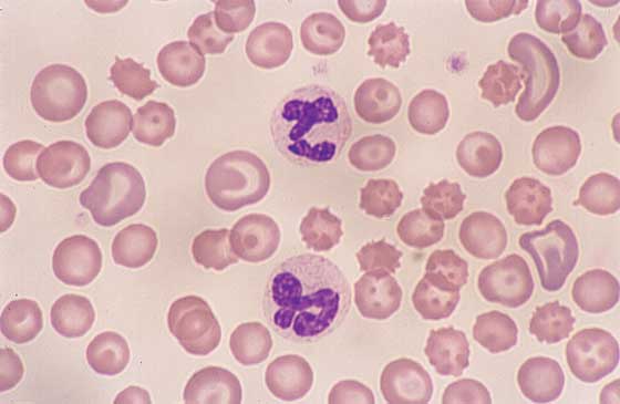 Normal canine neutrophils. Both neutrophils have a lobulated nucleus in a light pink finely granulated cytoplasm (100x).