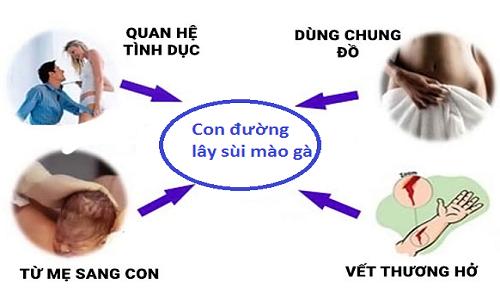 Con đường lây truyền sùi mào gà