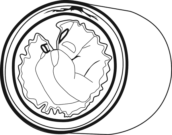 Illustration of a rectal mucosal biopsy