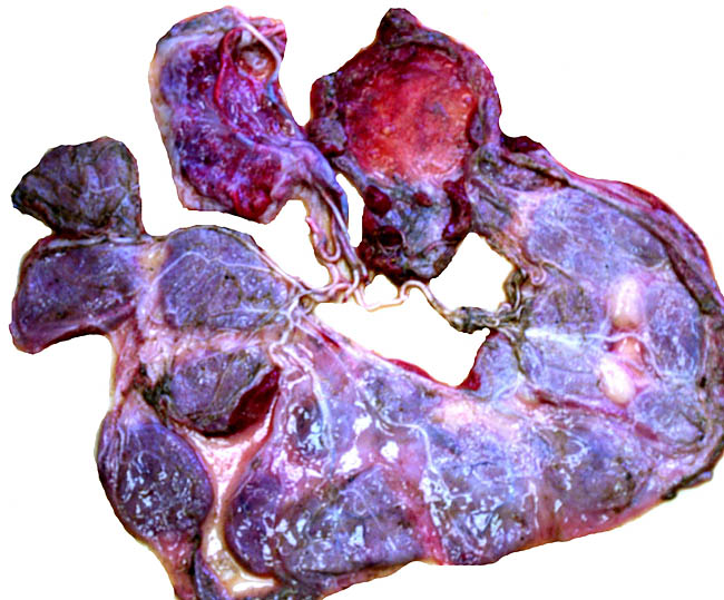 Sitatunga placenta from stillborn fetus