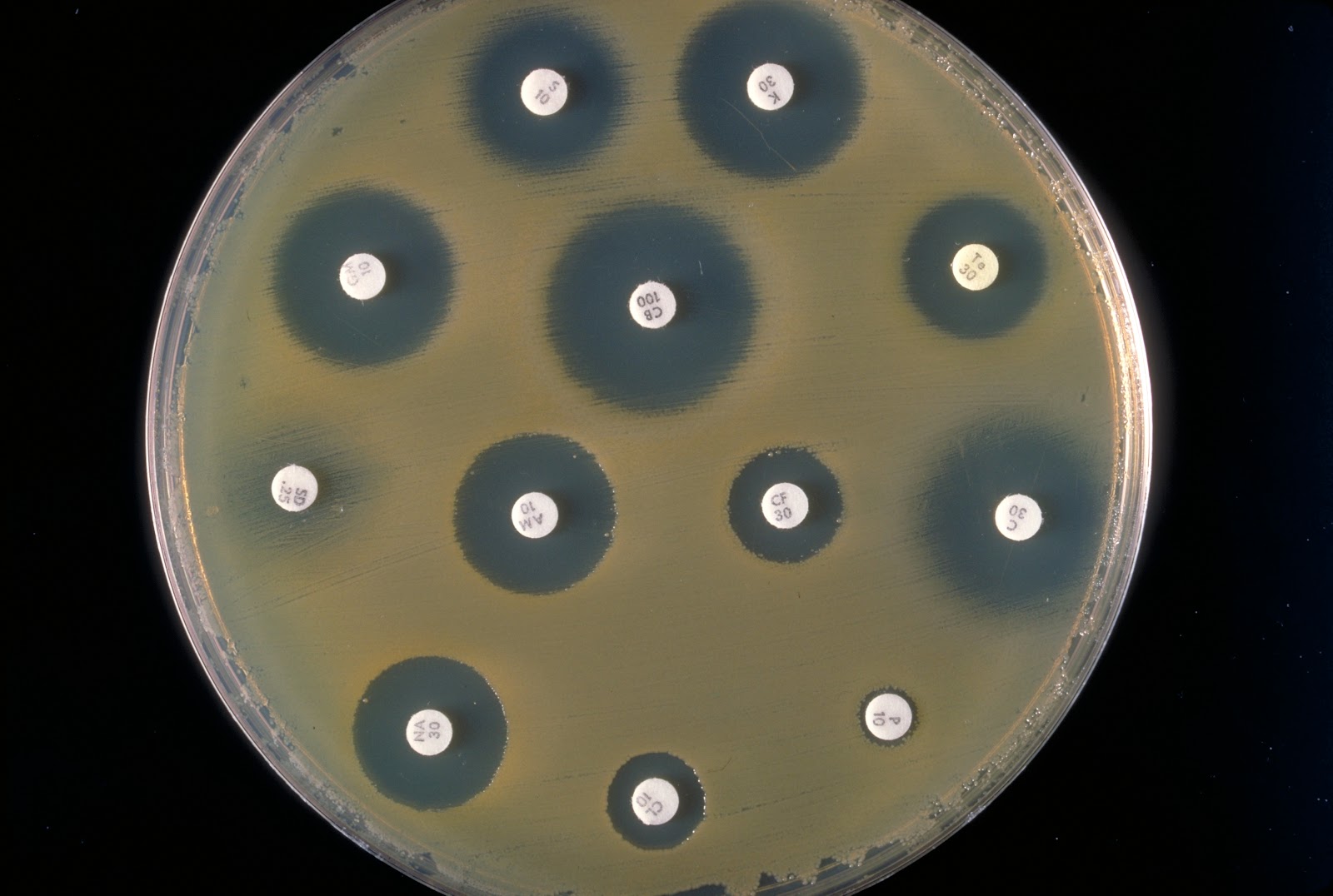 Antibiograma  o prueba realizada para comprobar la sensibilidad o resistencia de una bacteria a varios antibióticos. Las zonas clareadas son halos de inhibición,  resultado de la actividad antibiótica. Fuente | Wikipedia